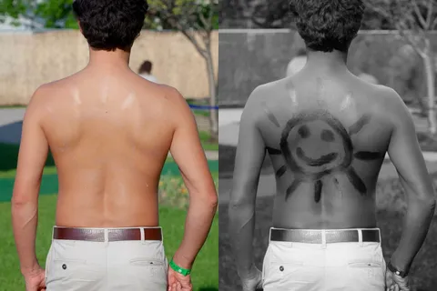 The same man's bare back photographed twice side by side. In ordinary light his skin looks almost uniform; in the ultraviolet photograph beside it, a sun with a smiling face stands out in black where sunscreen was applied